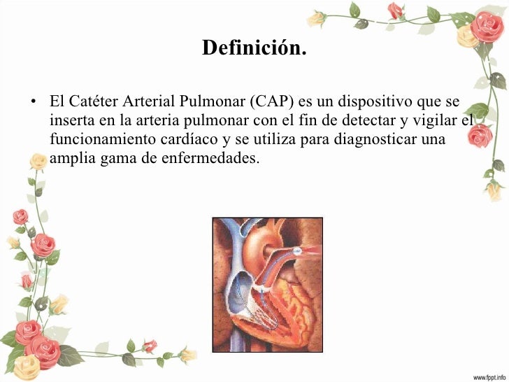 cateter swan ganz definicion